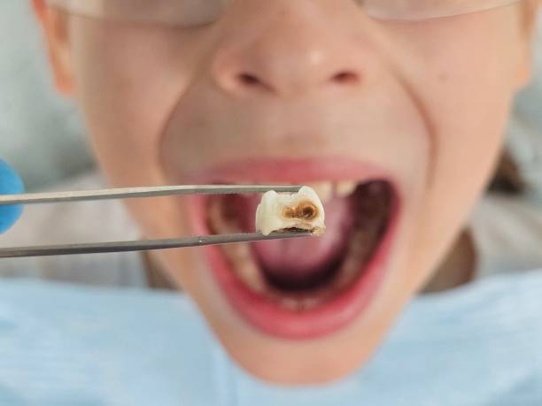 Best Emergency Pediatric Dental Care in Baldwinsville, NY